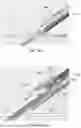 Fig. 45 - IMPLANTABLE DEVICES, SYSTEMS AND METHODS FOR CLOSING APERTURE