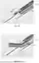 Fig. 48 - IMPLANTABLE DEVICES, SYSTEMS AND METHODS FOR CLOSING APERTURE