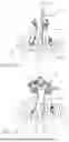 Fig. 53 - METHOD AND APPARATUS FOR PERFORMING SPINAL FUSION SURGERY