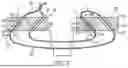 Fig. 04 - RETENTION SUTURE ASSEMBLY