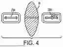 Fig. 05 - RETENTION SUTURE ASSEMBLY