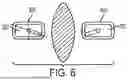 Fig. 07 - RETENTION SUTURE ASSEMBLY