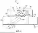 Fig. 10 - RETENTION SUTURE ASSEMBLY