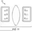 Fig. 12 - RETENTION SUTURE ASSEMBLY
