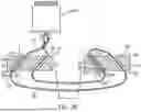 Fig. 21 - RETENTION SUTURE ASSEMBLY