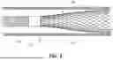 Fig. 04 - DEVICES FOR TREATMENT OF VASCULAR DEFECTS