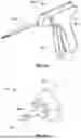 Fig. 22 - SURGICAL DEVICES FOR SOFT TISSUE AUGMENTATION