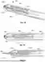 Fig. 26 - SURGICAL DEVICES FOR SOFT TISSUE AUGMENTATION