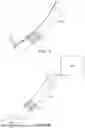Fig. 04 - APPARATUS AND METHODS FOR HYBRID ENDOSCOPIC AND LAPAROSCOPIC SURGERY