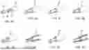 Fig. 30 - APPARATUS AND METHODS FOR HYBRID ENDOSCOPIC AND LAPAROSCOPIC SURGERY