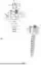 Fig. 02 - COUPLING DEVICE FOR COUPLING A ROD TO A BONE ANCHOR