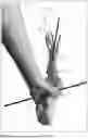 Fig. 02 - Apparatus and Method for Canine Elbow Correction