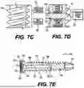 Fig. 08 - SCREW IMPLANTS FOR BONE FUSION