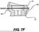 Fig. 09 - SCREW IMPLANTS FOR BONE FUSION