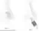 Fig. 08 - METHODS OF TREATING NASAL AIRWAYS