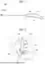 Fig. 02 - ELECTRODE DEVICE FOR BLOCKING OR CONTROLLING NERVES IN BODY