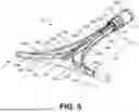 Fig. 06 - ENDOMETRIAL ABLATION METHOD