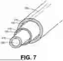 Fig. 08 - ENDOMETRIAL ABLATION METHOD