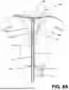 Fig. 09 - ENDOMETRIAL ABLATION METHOD