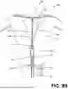 Fig. 10 - ENDOMETRIAL ABLATION METHOD