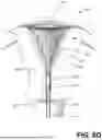 Fig. 12 - ENDOMETRIAL ABLATION METHOD