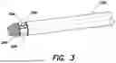 Fig. 04 - FUNDUS BUMPER MECHANICAL REFERENCE FOR EASIER MECHANISM DEPLOYMENT