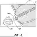 Fig. 06 - FUNDUS BUMPER MECHANICAL REFERENCE FOR EASIER MECHANISM DEPLOYMENT