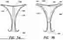 Fig. 08 - FUNDUS BUMPER MECHANICAL REFERENCE FOR EASIER MECHANISM DEPLOYMENT