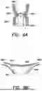 Fig. 10 - FUNDUS BUMPER MECHANICAL REFERENCE FOR EASIER MECHANISM DEPLOYMENT
