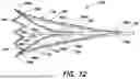 Fig. 13 - FUNDUS BUMPER MECHANICAL REFERENCE FOR EASIER MECHANISM DEPLOYMENT