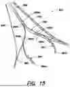 Fig. 16 - FUNDUS BUMPER MECHANICAL REFERENCE FOR EASIER MECHANISM DEPLOYMENT