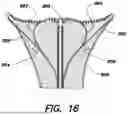 Fig. 17 - FUNDUS BUMPER MECHANICAL REFERENCE FOR EASIER MECHANISM DEPLOYMENT