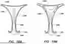 Fig. 20 - FUNDUS BUMPER MECHANICAL REFERENCE FOR EASIER MECHANISM DEPLOYMENT