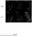 Fig. 04 - SYSTEM AND METHOD FOR LASER HAIR TREATMENT