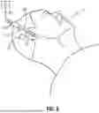 Fig. 10 - METHOD OF REGISTERING A PATIENT WITH MEDICAL INSTRUMENT NAVIGATION SYSTEM