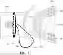 Fig. 11 - DENTAL VIBRATION DEVICE