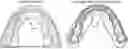 Fig. 01 - PRECISION ORTHODONTIC APPLIANCES AND METHODS OF MANUFACTURING SAME
