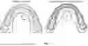 Fig. 02 - PRECISION ORTHODONTIC APPLIANCES AND METHODS OF MANUFACTURING SAME