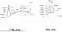 Fig. 03 - DENTURE BASE MATERIAL PACKAGE AND METHOD FOR CREATING DENTURE