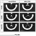 Fig. 27 - KITS FOR SURGICAL REPAIR OF SOFT TISSUE DEFECTS AND COMPONENTS, PACKAGING, AND METHODS OF USE THEREOF
