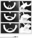 Fig. 29 - KITS FOR SURGICAL REPAIR OF SOFT TISSUE DEFECTS AND COMPONENTS, PACKAGING, AND METHODS OF USE THEREOF