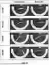 Fig. 30 - KITS FOR SURGICAL REPAIR OF SOFT TISSUE DEFECTS AND COMPONENTS, PACKAGING, AND METHODS OF USE THEREOF