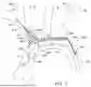 Fig. 07 - SYSTEMS AND METHODS FOR PROTECTING THE CEREBRAL VASCULATURE