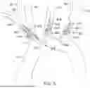 Fig. 09 - SYSTEMS AND METHODS FOR PROTECTING THE CEREBRAL VASCULATURE