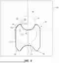Fig. 03 - TRANSLUMINAL STENTS AND RELATED METHODS