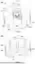 Fig. 07 - IMPLANT DELIVERY