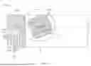 Fig. 12 - IMPLANT DELIVERY
