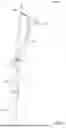 Fig. 21 - IMPLANT DELIVERY