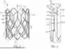 Fig. 03 - LEAFLET FRAME ATTACHMENT FOR PROSTHETIC VALVES