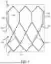 Fig. 04 - LEAFLET FRAME ATTACHMENT FOR PROSTHETIC VALVES
